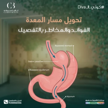 تحويل مسار المعدة: الفوائد والمخاطر بالتفصيل