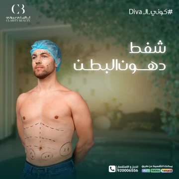 شفط دهون البطن: التجربة الكاملة من العملية إلى النتائج