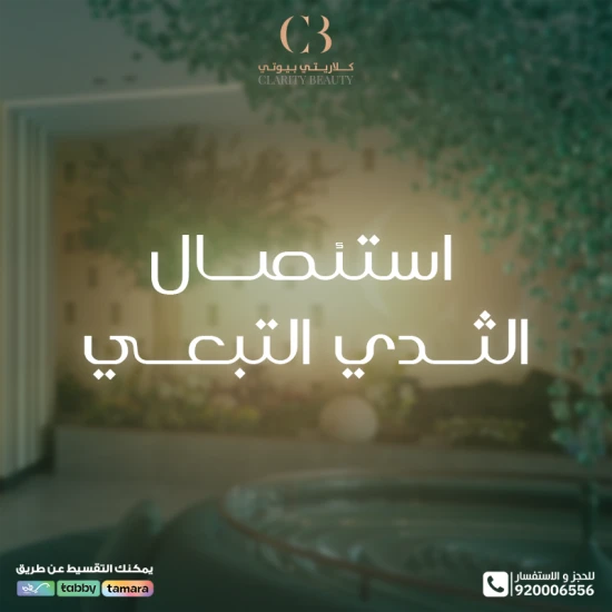 استئصال الثدي التبعي: متى يكون الحل الأنسب؟