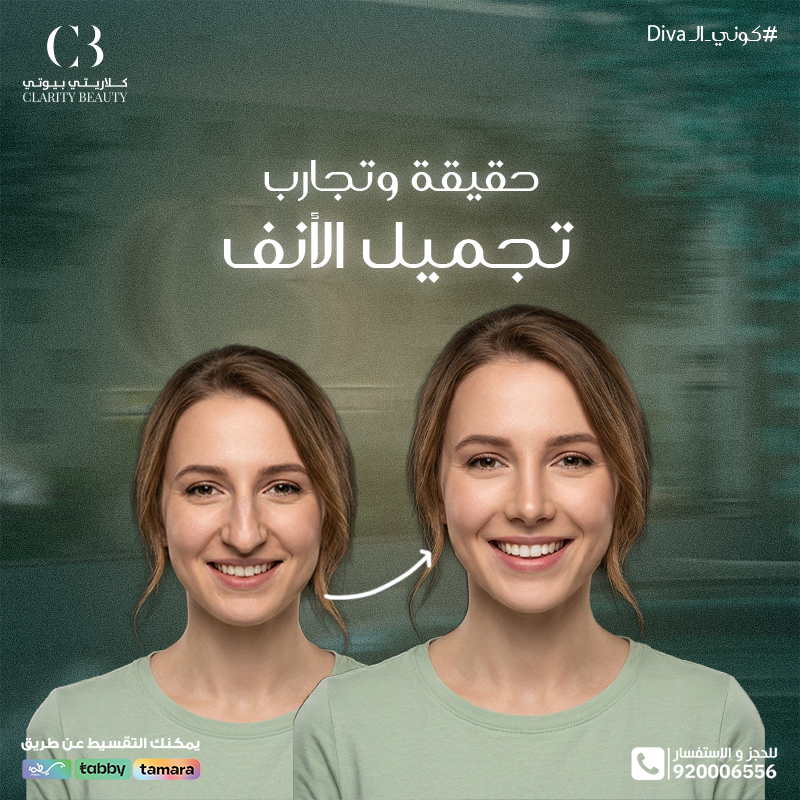حقيقة وتجارب تجميل الأنف: هل النتيجة تستحق؟
