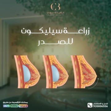 زراعة سيليكون للصدر: الفوائد والمخاطر