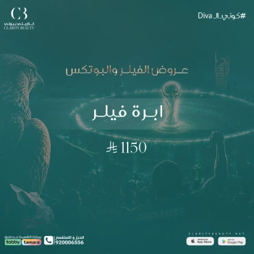 ابرة فيلر