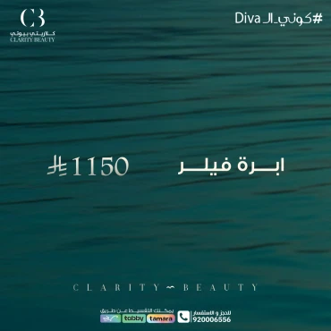 ابرة فيلر