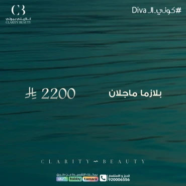 بلازما ماجلان