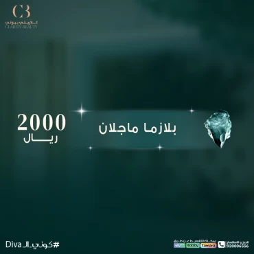 بلازما ماجلان