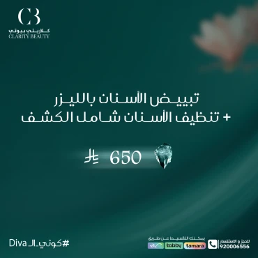 تبييض الأسنان بالليزر + تنظيف الأسنان شامل الكشف