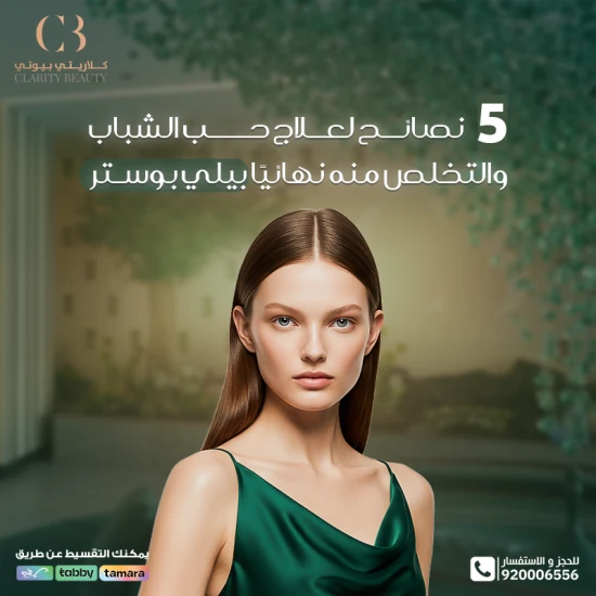 5 نصائح لعلاج حب الشباب والتخلص منه نهائيًا