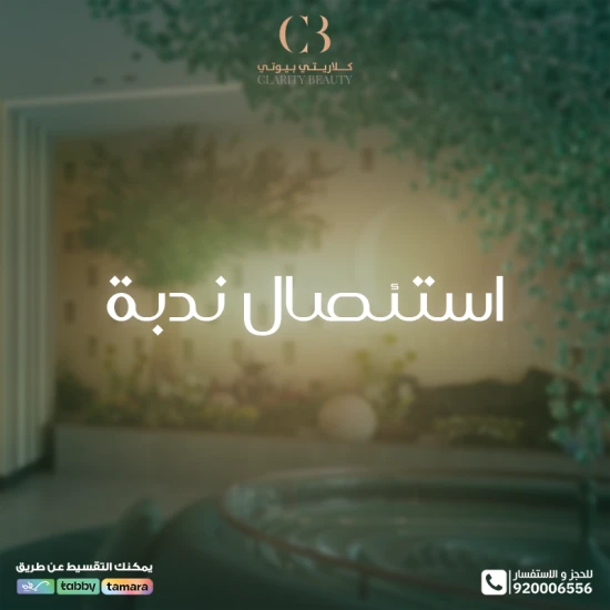 استئصال ندبة: تقنيات حديثة لشفاء أسرع ومظهر أفضل