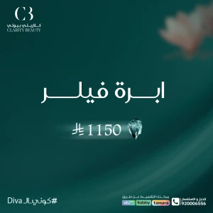 ابرة فيلر