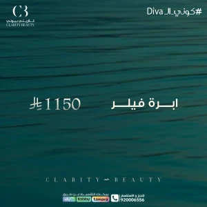 ابرة فيلر