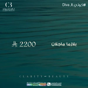 بلازما ماجلان
