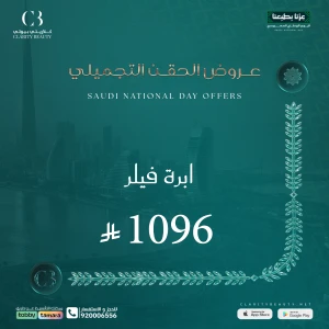 ابرة فيلر